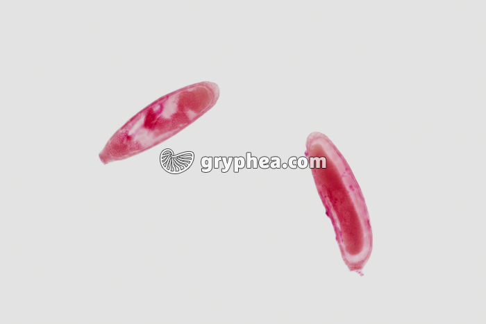 Mnium (Mousse) - Anthéridies dissociées x40 - gryphea.org